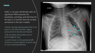 CASE 1: a 6-year-old female with no
significant PMH presents for
headache, vomiting, and diarrhea for
the past 1.5 months that has acutely
worsened in the last 2 weeks.
-Ovoid, sharply demarcated 5x3.5 cm
mass in the left perihilar region
(presumed to be pleural-based)
-Ddx includes pericardial cyst vs
bronchogenic cyst
-Lucent lesion in the proximal left
humerus concerning for a bone cyst
or non-ossifying fibroma
 