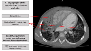 Drs. Potter and Richardson's CMC Pediatric X-Ray Mastery January Cases ...