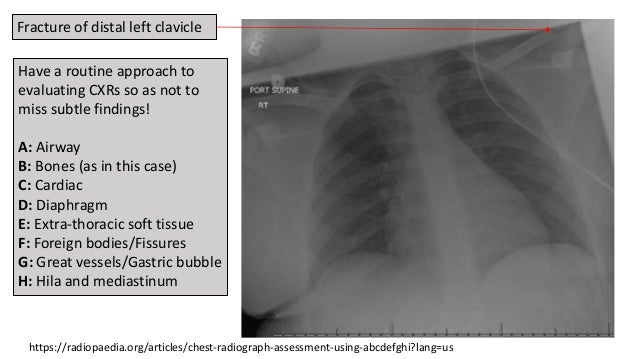 Drs Potter And Richardson S Cmc Pediatric X Ray Mastery September Ca