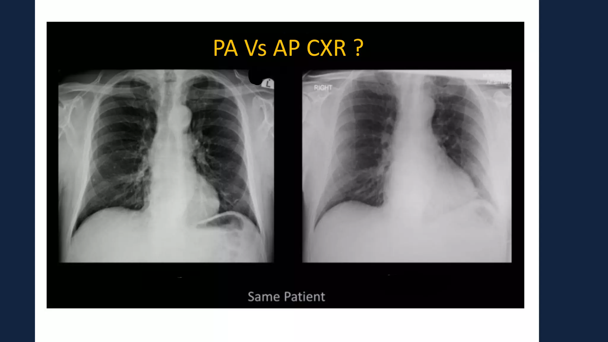 Pediatric Chest X Ray Interpretation pdf