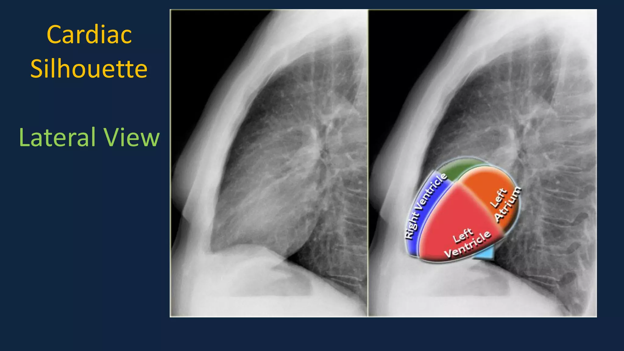Pediatric Chest x ray Interpretation.pdf