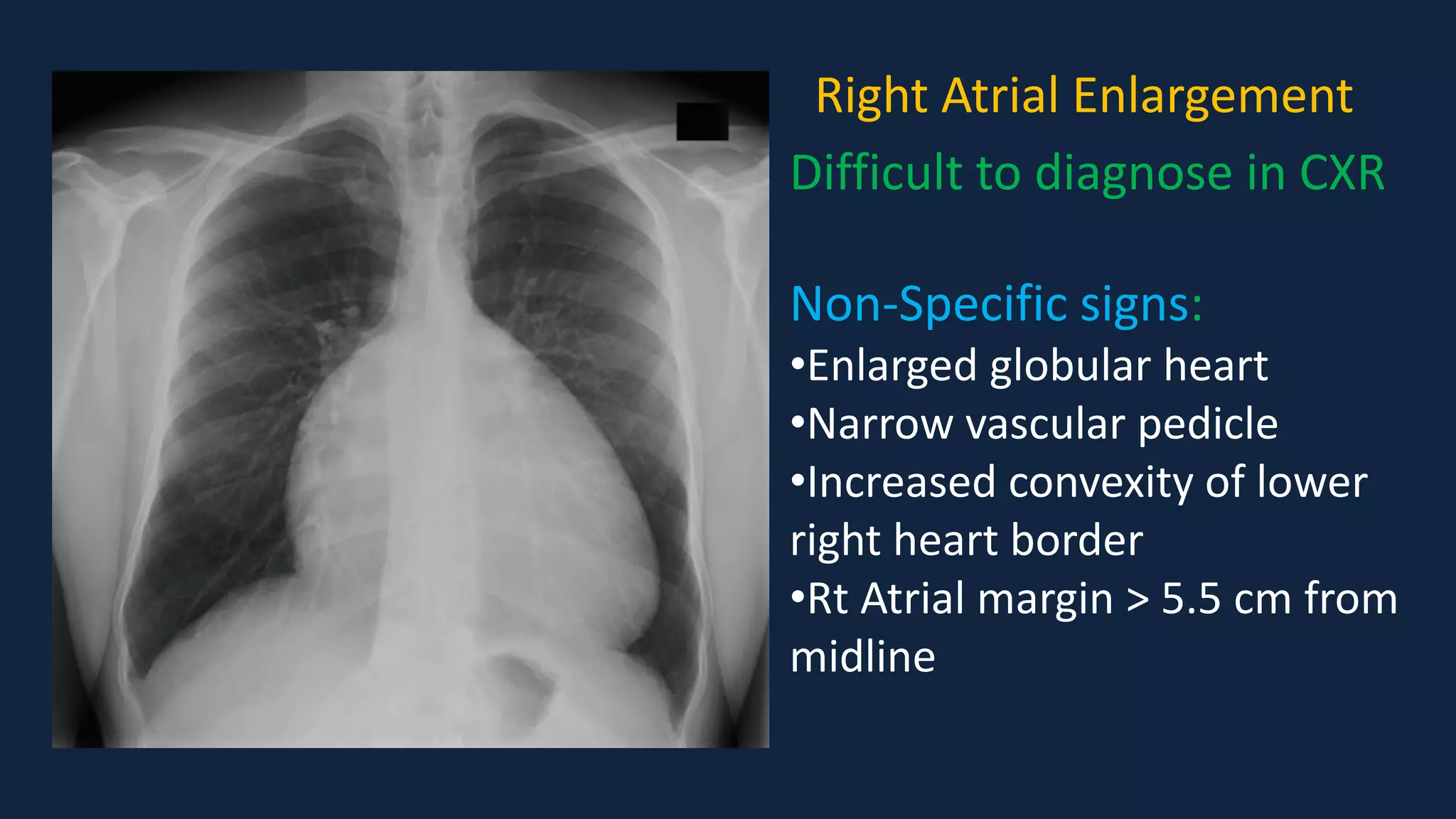 Pediatric Chest x ray Interpretation.pdf