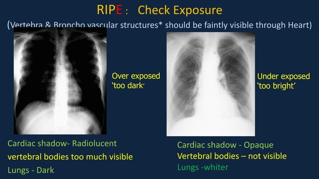 Pediatric Chest x ray Interpretation.pdf