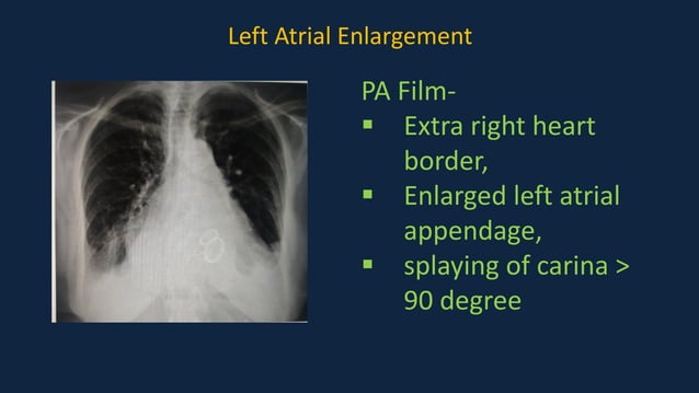 Pediatric Chest x ray Interpretation.pdf