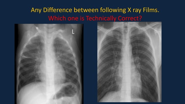 Pediatric Chest x ray Interpretation.pdf