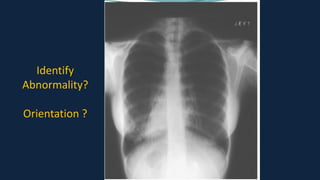Pediatric Chest x ray Interpretation.pdf