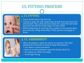 CL FITTING PROCESS
 