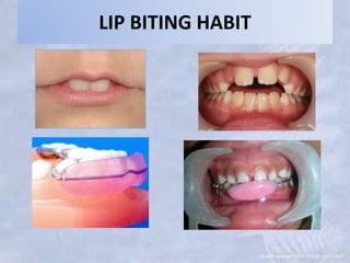 Pediatric dentistry | PPTX