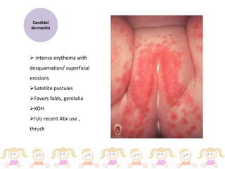 Pediatric Dermatology - Dr Maryam K Alnajem | PPTX