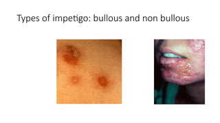 Pediatric Dermatology.pptx nursing notes | PPTX