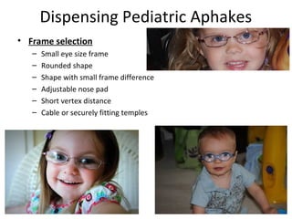 Dispensing Pediatric Aphakes
• Frame selection
– Small eye size frame
– Rounded shape
– Shape with small frame difference
– Adjustable nose pad
– Short vertex distance
– Cable or securely fitting temples
 