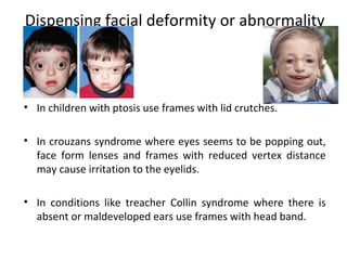 Dispensing facial deformity or abnormality
• In children with ptosis use frames with lid crutches.
• In crouzans syndrome where eyes seems to be popping out,
face form lenses and frames with reduced vertex distance
may cause irritation to the eyelids.
• In conditions like treacher Collin syndrome where there is
absent or maldeveloped ears use frames with head band.
 
