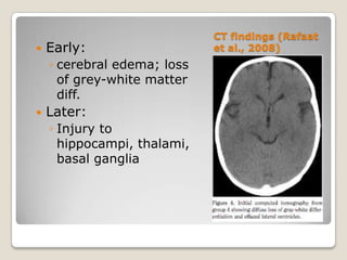 CT findings (Rafaat
   Early:                   et al., 2008)
    ◦ cerebral edema; loss
      of grey-white matter
      diff.
   Later:
    ◦ Injury to
      hippocampi, thalami,
      basal ganglia
 