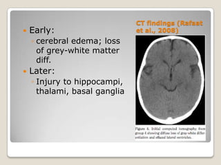 CT findings (Rafaat
   Early:                     et al., 2008)
    ◦ cerebral edema; loss
      of grey-white matter
      diff.
   Later:
    ◦ Injury to hippocampi,
      thalami, basal ganglia
 
