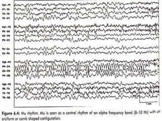 Pediatric EEG.pptx