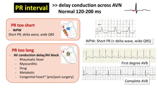 Pediatric EKG_Kalasin 2025_handout upload 310126.pdf