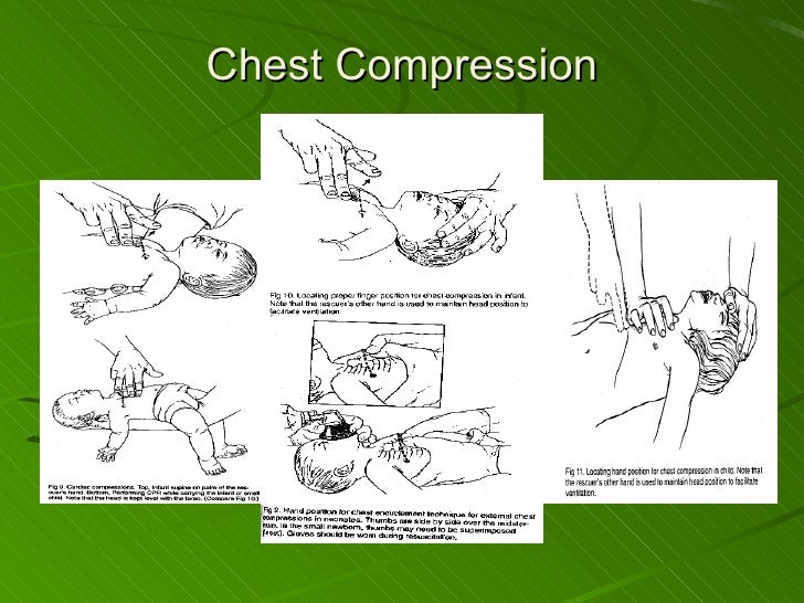 compression to ventilation ratio compression to ventilation ratio