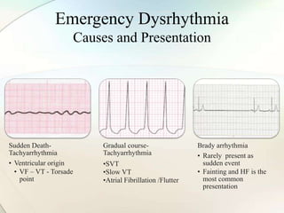 Emergency Dysrhythmia
Causes and Presentation
Sudden Death-
Tachyarrhythmia
• Ventricular origin
• VF – VT - Torsade
point
Gradual course-
Tachyarrhythmia
•SVT
•Slow VT
•Atrial Fibrillation /Flutter
Brady arrhythmia
• Rarely present as
sudden event
• Fainting and HF is the
most common
presentation
 