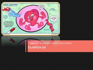 TAMPONAD
Diagnosis is critical for early intervention
 