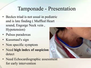 Tamponade - Presentation
• Beckes triad is not usual in pediatric
and is late finding ( Muffled Heart
sound, Engorge Neck vein ,
Hypotension)
• Pulsus paradoxus
• Kussmaul's sign
• Non specific symptom
• Need high index of suspicion to
detect
• Need Echocardiographic assessment
for early intervention
 