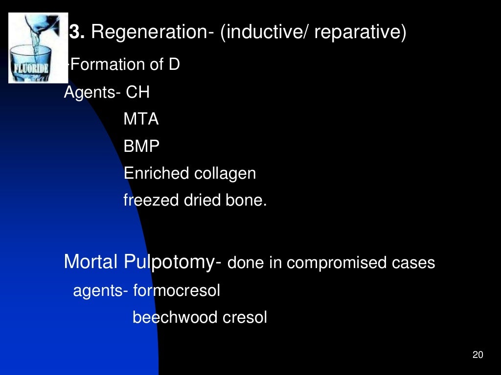 Pediatric endodontics
