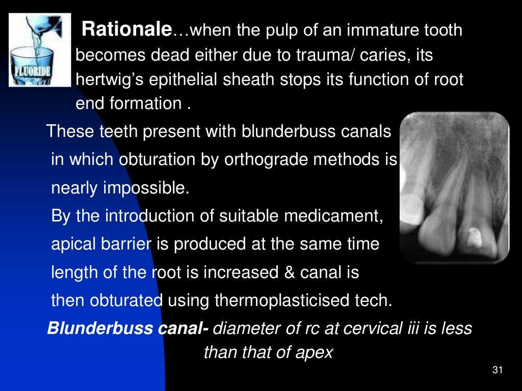 Pediatric endodontics