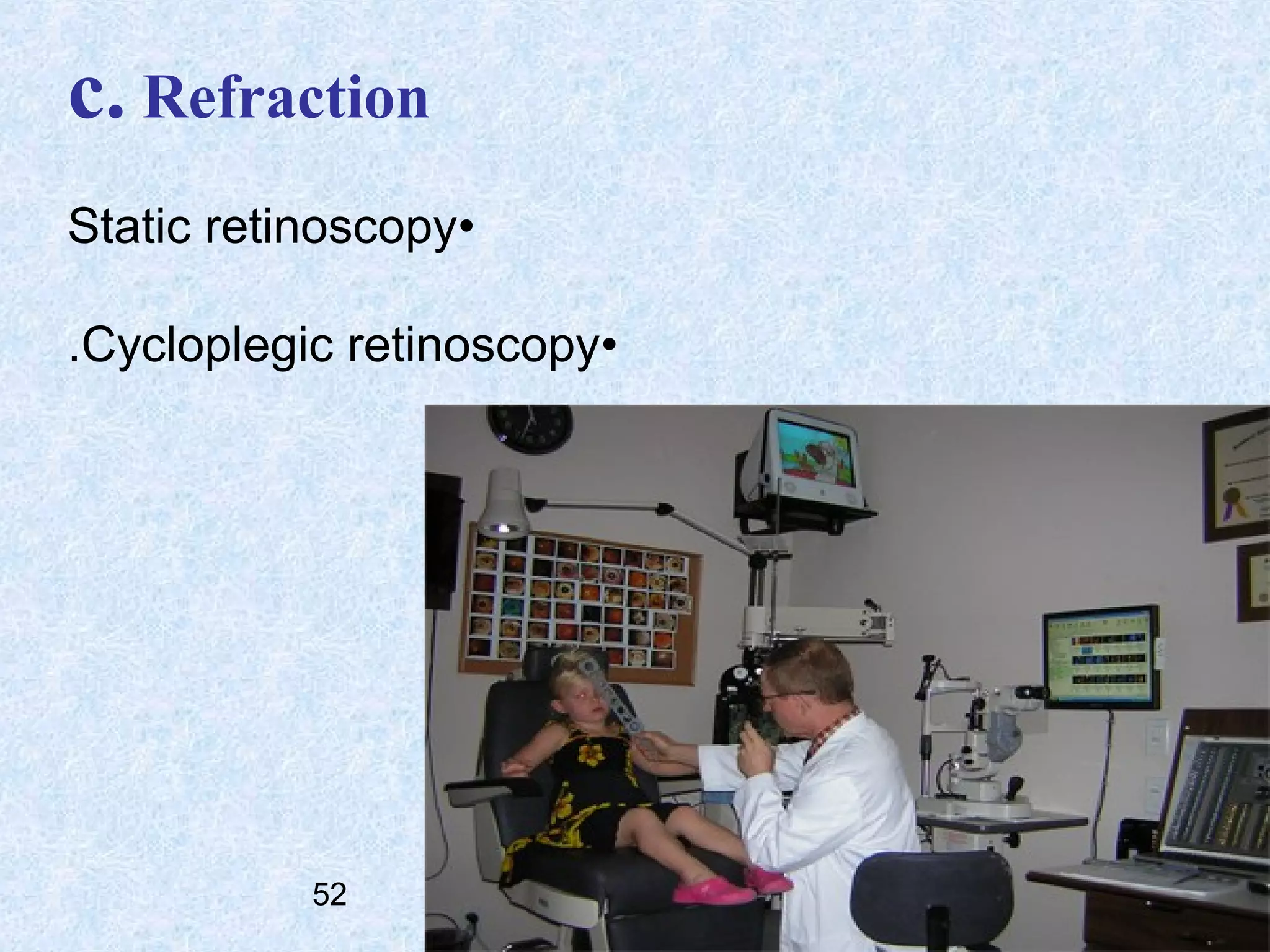 c. Refraction
Static retinoscopy•
.Cycloplegic retinoscopy•

52

 