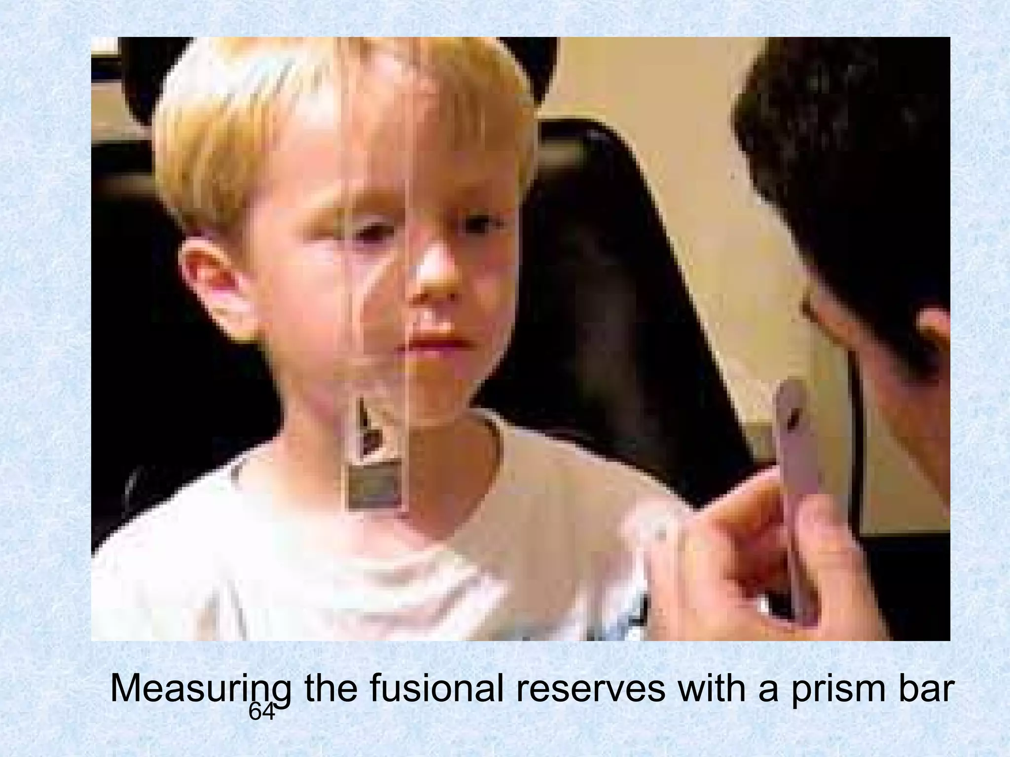 Measuring the fusional reserves with a prism bar
64

 