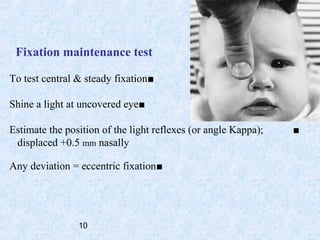 Fixation Preference Testing Pediatric eye and vision | PPT