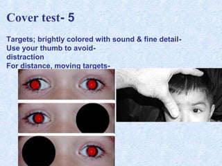Pediatric eye and vision | PPT