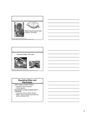 “Babies are like bags of water”
                                            Full-term: 75% water



http://chfs.ky.gov/dph/ach/ecd/newbornscreening.htm
http://www.inmagine.com/rubberball-single-image-set-photos/Rubberball-rbv005




                Premature babies: 83% water




http://www.sciencemuseum.org.uk/antenna/babybrainscans/
http://www.jupiterimages.com/popup2.aspx?navigationSubType=itemdetails&itemID =22684522




                      Regulating Water and
                          Electrolytes
     • What makes someone thirsty?
           – Increase in serum osmolarity
           – Volume depletion
     • Dehydration causes increased serum
       osmolarity
           – Antidiuretic hormone (ADH) released
           – SIADH – ADH is released even when the
             serum osmolarity is low




                                                                                          3
 