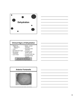 Dehydration




         Clinical Signs of Dehydration
     • Weight loss                • Babies - sunken
          – Weigh children          fontanelle
            frequently
                                  • Decreased urine
     •   Thirst
                                    production
     •   Decreased skin turgor
                                  • Increased urine
     •   Dry mucous
         membranes                  specific gravity
     •   Lack of tears            • Increased heart rate
                                  • Decreased blood
                                    pressure
                   What are the implications of
                 dehydration for drug therapy?




                      Anterior Fontanelle




http://commons.wikimedia.org/wiki/Image:Human_anterior_fontanelle_1_month_dscn1449.jpg




                                                                                         9
 