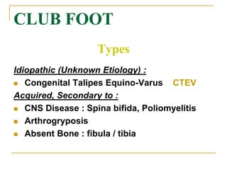 Ctev Types Pediatric foot deformities | PPT