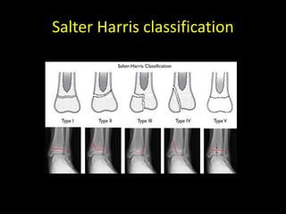 Pediatric_Fractures_QT.pdf