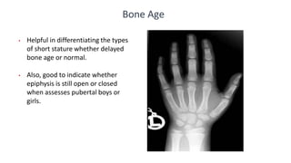 Bone Age
• Helpful in differentiating the types
of short stature whether delayed
bone age or normal.
• Also, good to indicate whether
epiphysis is still open or closed
when assesses pubertal boys or
girls.
 
