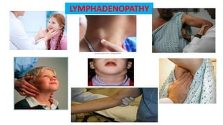 LYMPHADENOPATHY
 