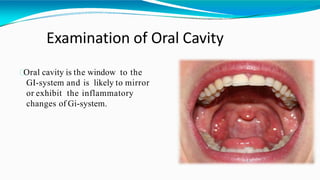 Examination of Oral Cavity
Oral cavity is the window to the
GI-system and is likely to mirror
or exhibit the inflammatory
changes of Gi-system.
 
