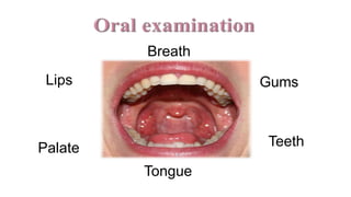 Lips Gums
Teeth
Tongue
Palate
Breath
 
