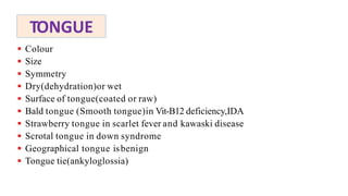 TONGUE
 Colour
 Size
 Symmetry
 Dry(dehydration)or wet
 Surface of tongue(coated or raw)
 Bald tongue (Smooth tongue)in Vit-B12 deficiency,IDA
 Strawberry tongue in scarlet fever and kawaski disease
 Scrotal tongue in down syndrome
 Geographical tongue isbenign
 Tongue tie(ankyloglossia)
 
