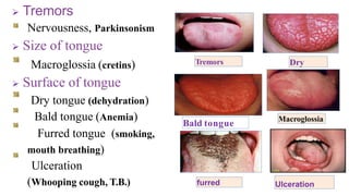 Tremors Dry
Macroglossia
 Tremors
Nervousness, Parkinsonism
 Size of tongue
Macroglossia (cretins)
 Surface of tongue
Dry tongue (dehydration)
Bald tongue (Anemia)
Furred tongue (smoking,
mouth breathing)
Ulceration
(Whooping cough, T.B.) furred Ulceration
Bald tongue
 