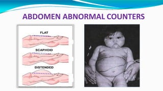 ABDOMEN ABNORMAL COUNTERS
 