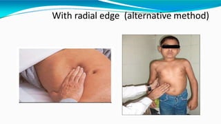 With radial edge (alternative method)
 
