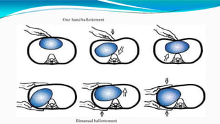 One hand ballottement
Bimanual ballottement
 