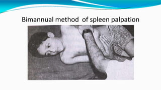 Bimannual method of spleen palpation
 