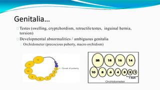 Genitalia…
Testes (swelling, cryptchordism, retractile testes, inguinal hernia,
torsion)
Developmental abnormalities / ambiguous genitalia
Orchidometer (precocious puberty, macro orchidism)
 