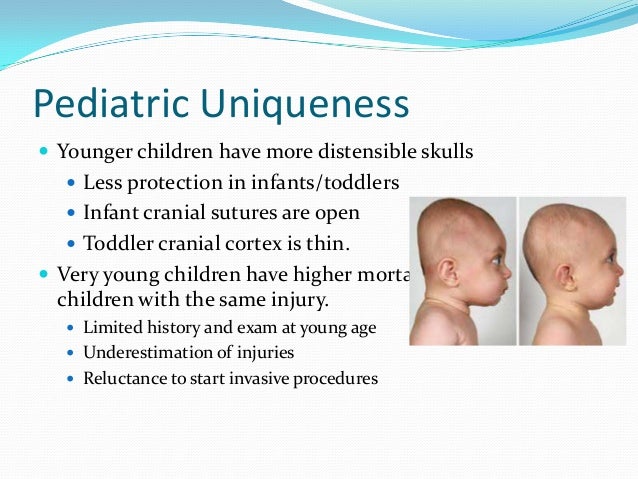 The Economics Of Pediatric Head Injury