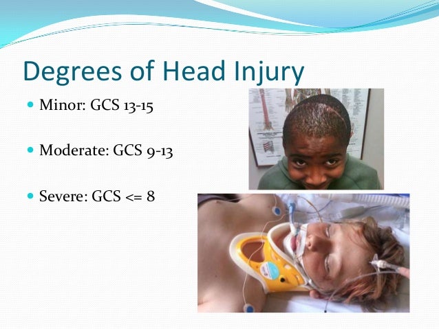 Pediatric head injury public
