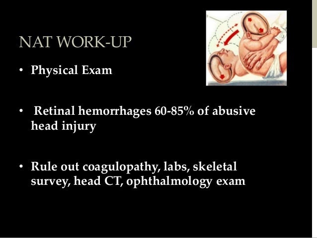 Aiding a Family Member Healing from a Traumatic Brain Injury