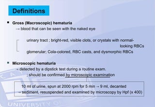  Gross (Macroscopic) hematuria
→ blood that can be seen with the naked eye
urinary tract ; bright-red, visible clots, or crystals with normal-
looking RBCs
glomerular; Cola-colored, RBC casts, and dysmorphic RBCs
 Microscopic hematuria
→ detected by a dipstick test during a routine exam.
; should be confirmed by microscopic examination
10 ml of urine, spun at 2000 rpm for 5 min → 9 ml, decanted
→ sediment, resuspended and examined by microscopy by Hpf (x 400)
Definitions
 