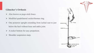 Glimcher’s Orthosis
 Also known as pogo-stick brace.
 Modified quadrilateral socket/thomas ring.
 One posterior upright extending from ischial seat to just
below the heel without knee and ankle joint.
 A rocker bottom for easy propulsion.
 Shoulder suspension starp.
 